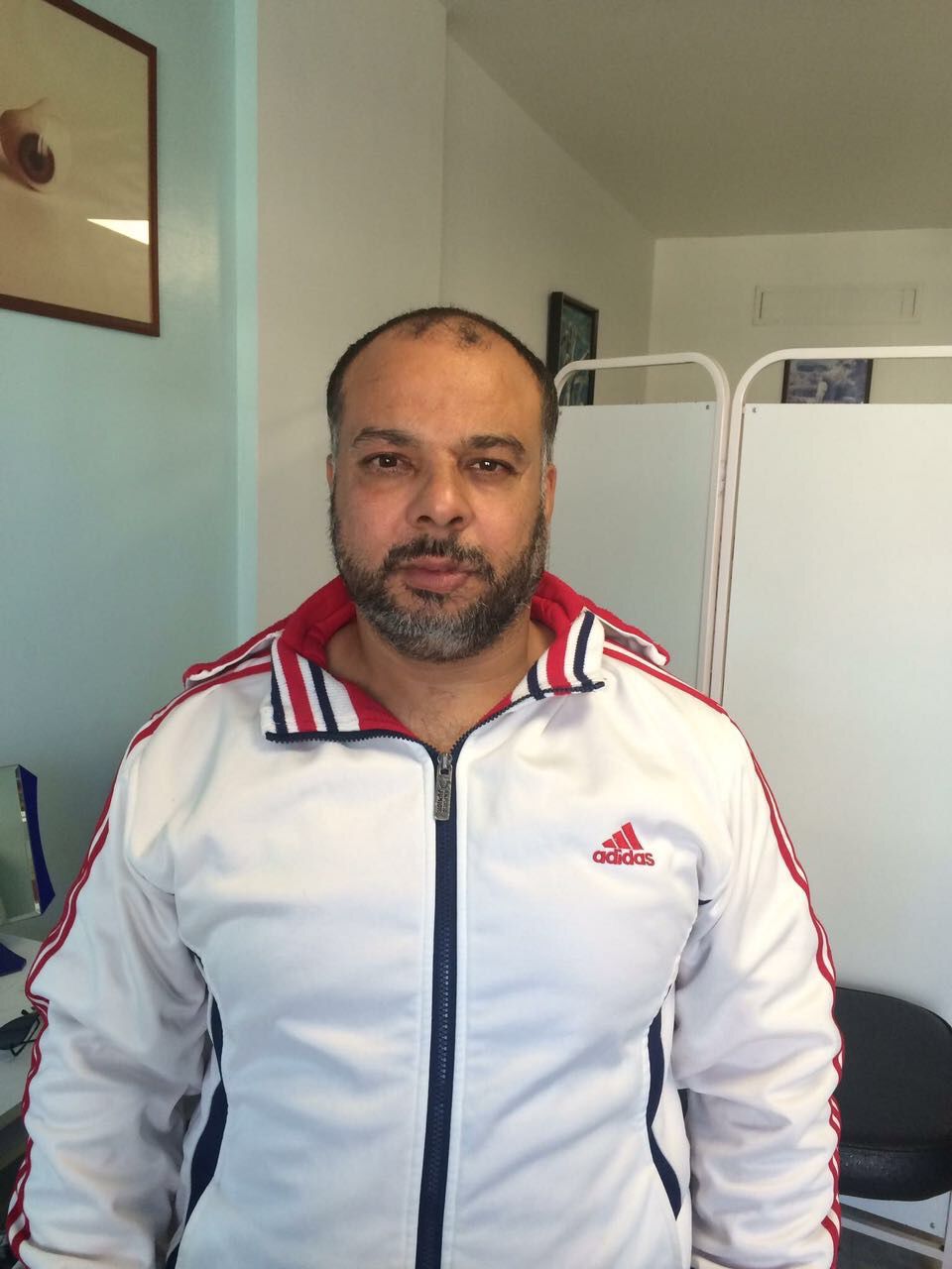 العين الإصطناعية ثلاثية الأبعاد المصنوعة من مادة resine synthetic ومهارة الأخصائي سامر كحيل في المركز اللبناني السويسري