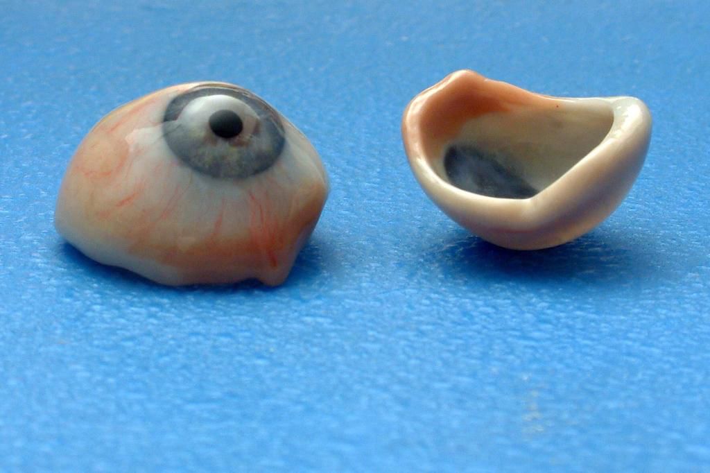 العين الإصطناعية ثلاثية الأبعاد المصنوعة من مادة resine synthetic ومهارة الأخصائي سامر كحيل في المركز اللبناني السويسري